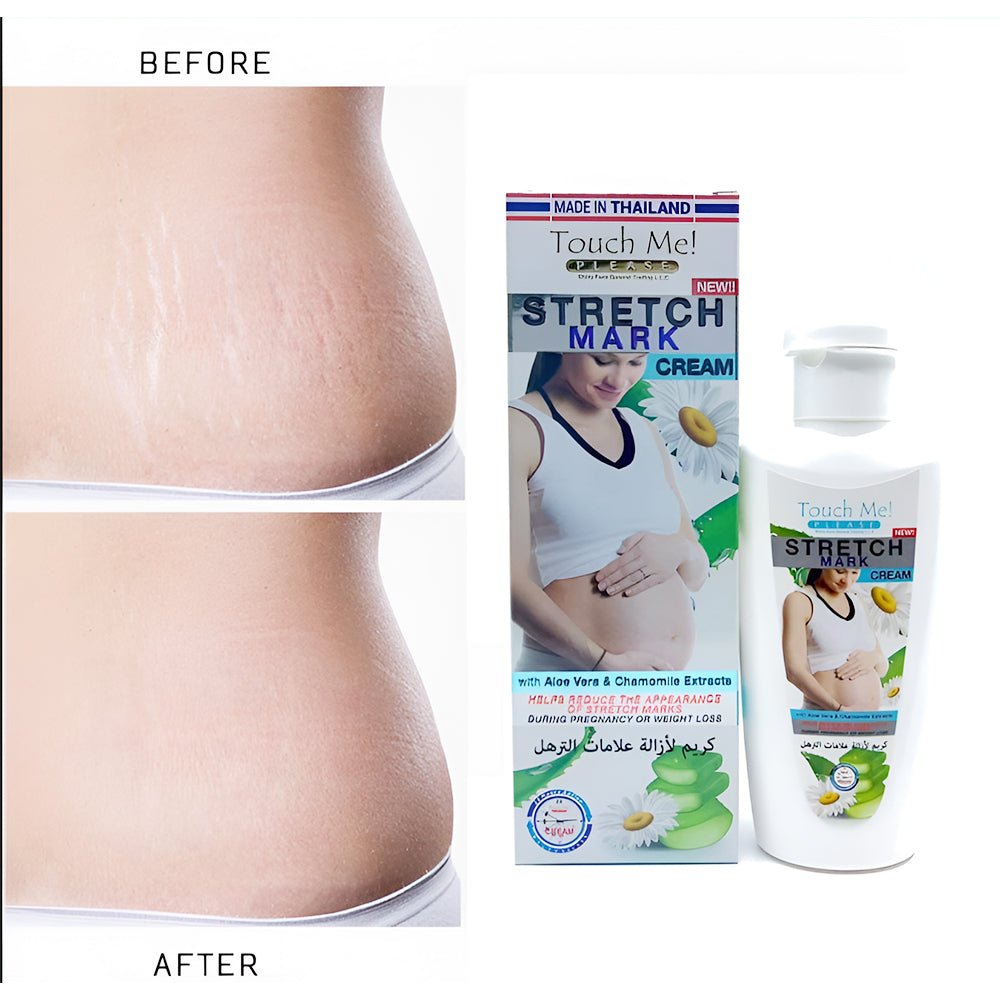 Touch Me Stretch Mark Removal Cream - 100ml