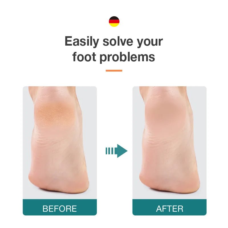 Mr. Green Double-Sided Foot Cooler and Crack Remover 
