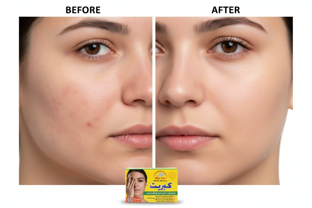 العطار صابون الكبريت للوجه والجسم 100 جم