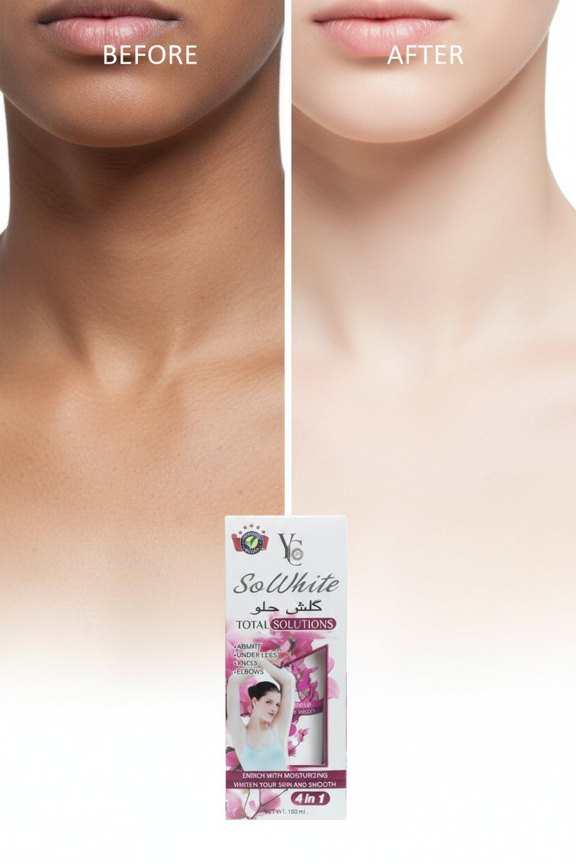 كريم التبييض 100 مل YC So White Total Solutions 4 in 1